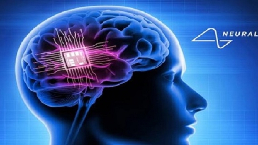 Chip não của tỷ phú Musk mở ra hy vọng mới cho bệnh nhân bị liệt