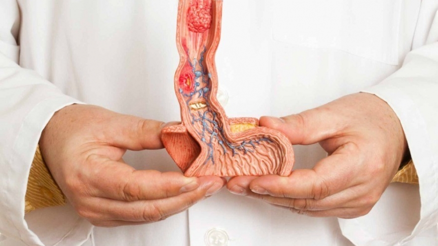 Những thói quen khiến người trẻ dễ mắc ung thư dương vật