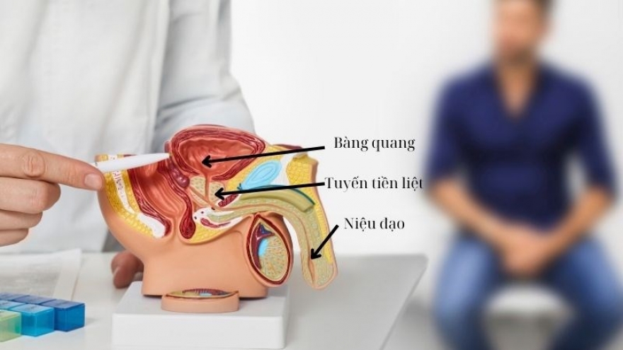 Bác sĩ nói u tiền liệt tuyến chưa to, vì sao vẫn tiểu đêm, tiểu không tự chủ?