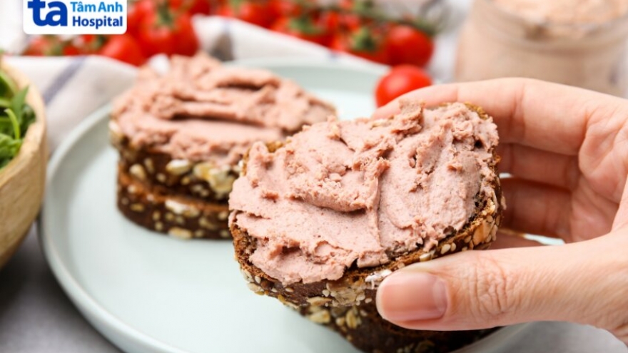 Vì sao pate dễ gây ngộ độc và cách xử lý để tránh hậu quả nặng nề
