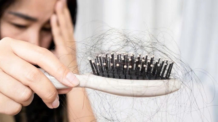 3 loại thực phẩm quen thuộc nhưng là “thủ phạm” khiến tóc rụng nhiều