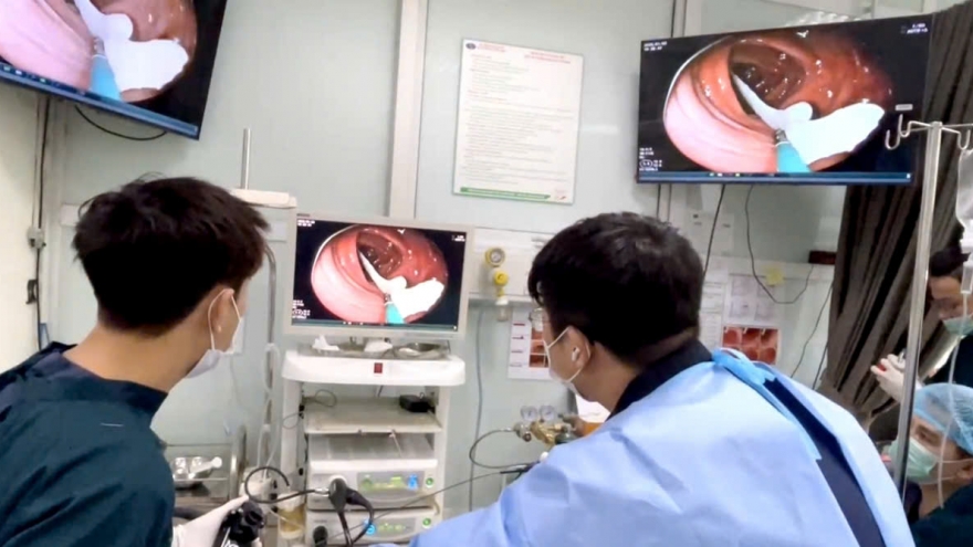 Phát hiện sán dây dài gần 1 mét trong đại tràng người đàn ông mê ăn đồ tái