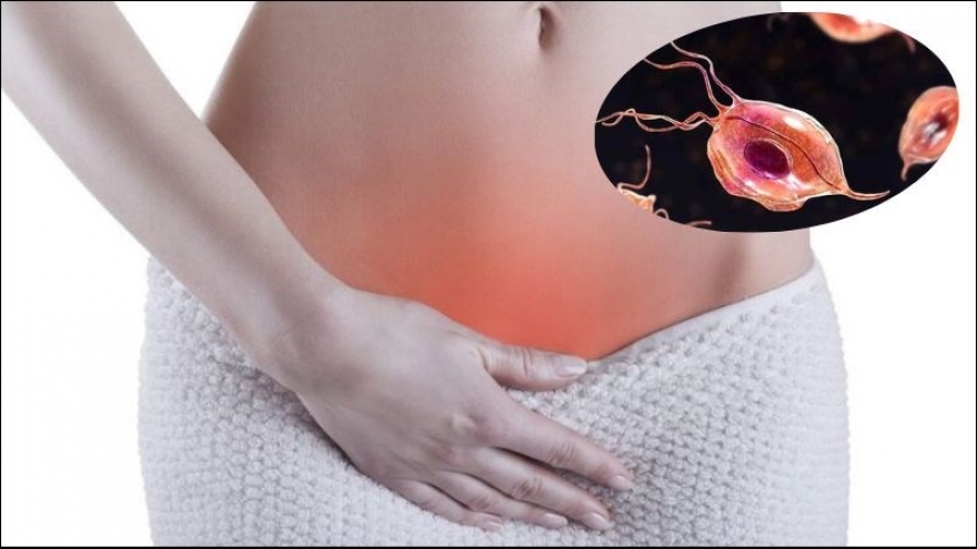 Vì sao vùng kín có mùi hôi sau khi quan hệ vợ chồng?