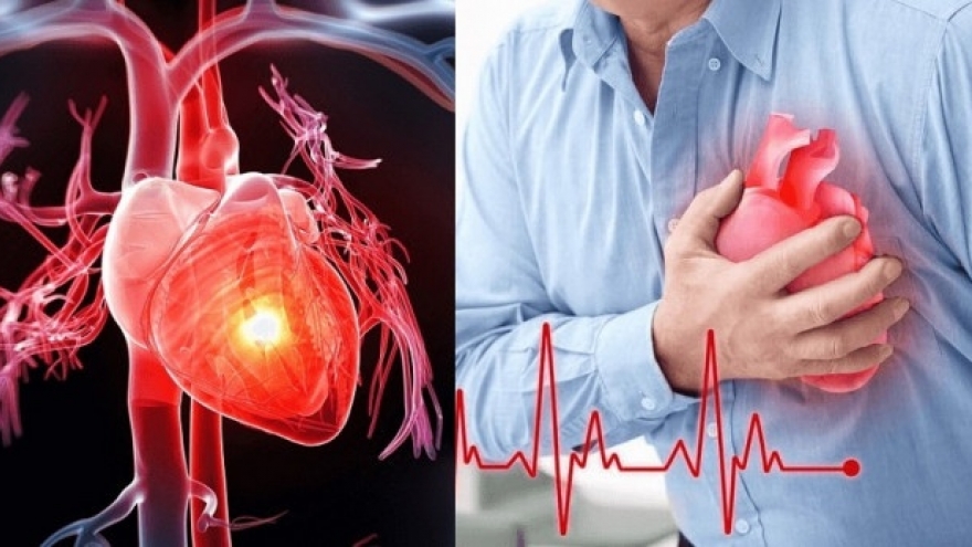 Rét đậm - thử thách với sức khỏe tim, phổi và mạch máu