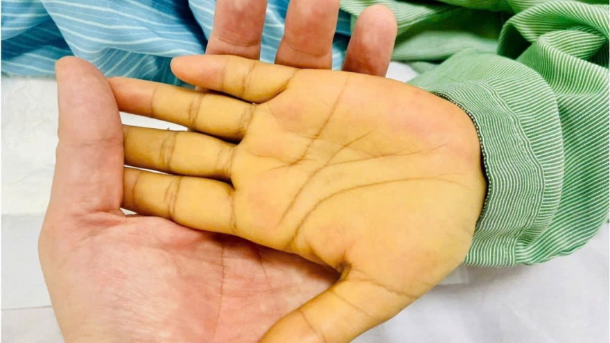 2 vị trí có màu vàng cảnh báo nguy hiểm không nên bỏ qua