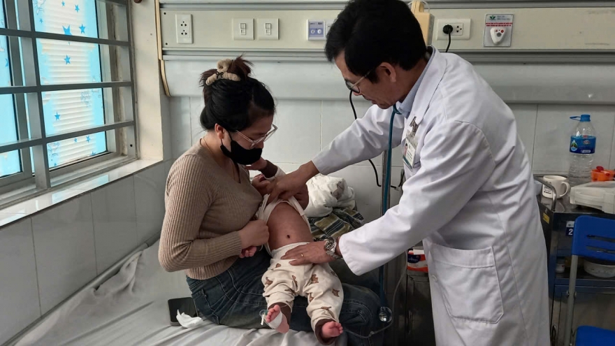 Cúm, sởi mùa Đông - Xuân gia tăng: Cách bảo vệ trẻ em trước dịch bệnh