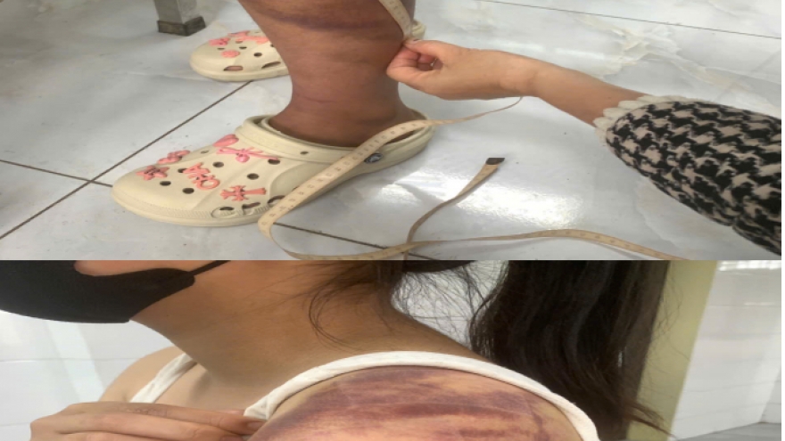 Tạm giữ người đàn ông nhiều lần bạo hành vợ đang mang thai và con gái 13 tuổi