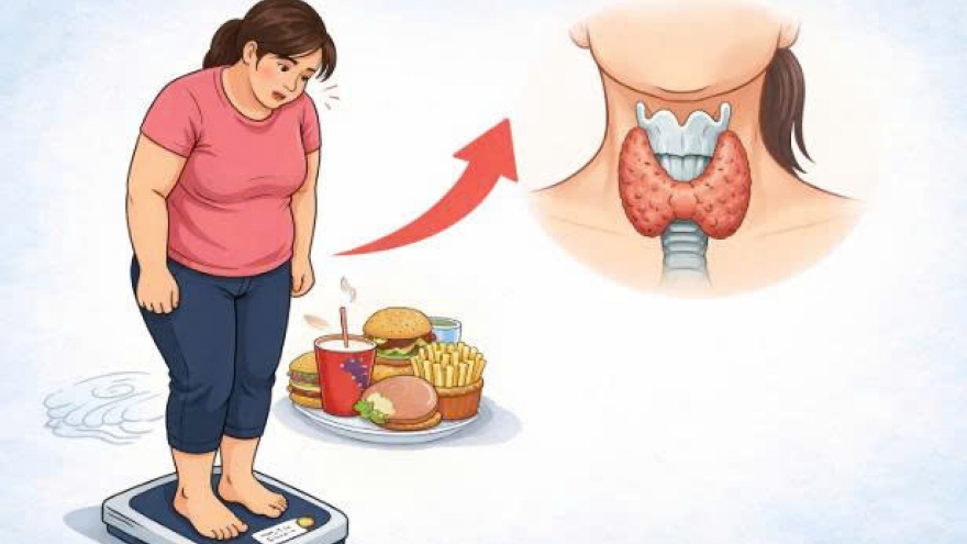 Vì sao ăn mãi vẫn gầy? Những nguyên nhân ít ai ngờ và cách cải thiện