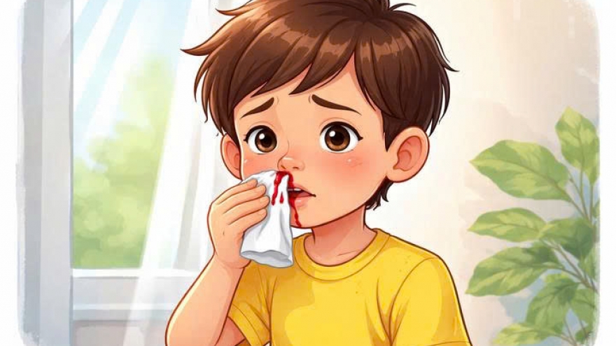 Vì sao chảy máu mũi lại gọi là chảy máu cam?