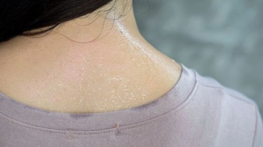 Mồ hôi muối: Bình thường hay cảnh báo sức khỏe tiềm ẩn?