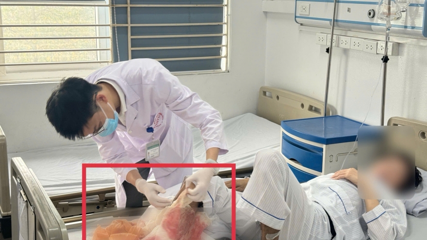 Suýt mất chân vì đắp lá chữa bỏng lửa suốt 1 tháng