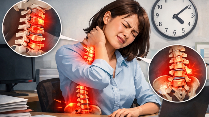 30 tuổi đã thoái hóa đốt sống cổ, bất ngờ 'thủ phạm' bào cột sống dân văn phòng