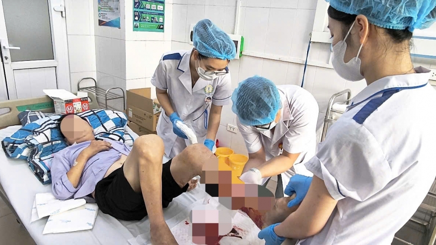 Biến chứng hoại tử nguy kịch: Sai lầm trong xử lý vết thương tại nhà