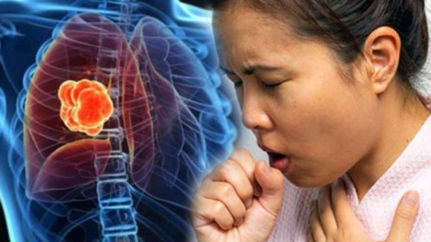 2 dấu hiệu khi ho cảnh báo ung thư phổi dễ bị bỏ qua