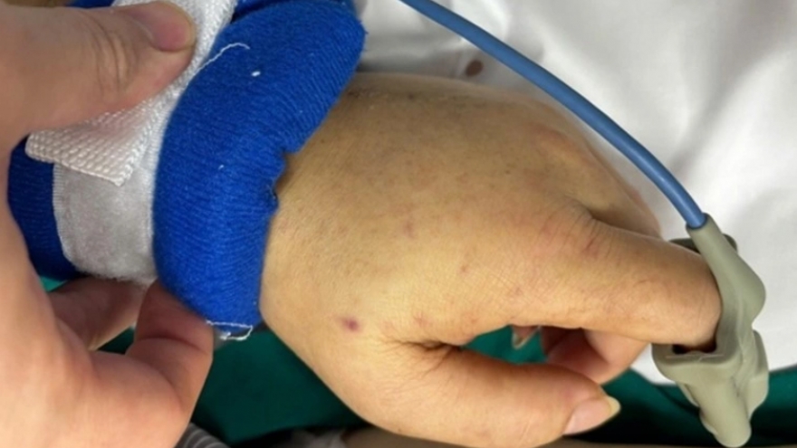 Cà Mau ghi nhận 3 ca nghi mắc bệnh viêm não mô cầu