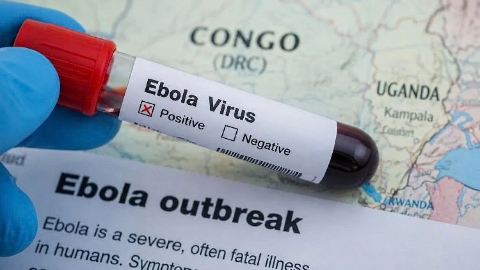 Bộ Y tế bổ sung quy định về dấu hiệu nhận biết, giám sát bệnh do virus Ebola