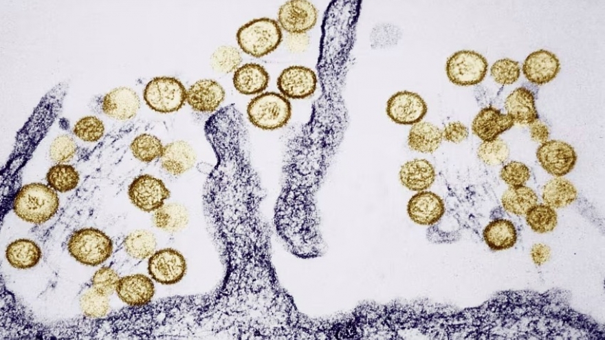 Dịch bệnh bùng phát trên tàu xuyên Đại Tây Dương: Sự nguy hiểm của virus Hanta