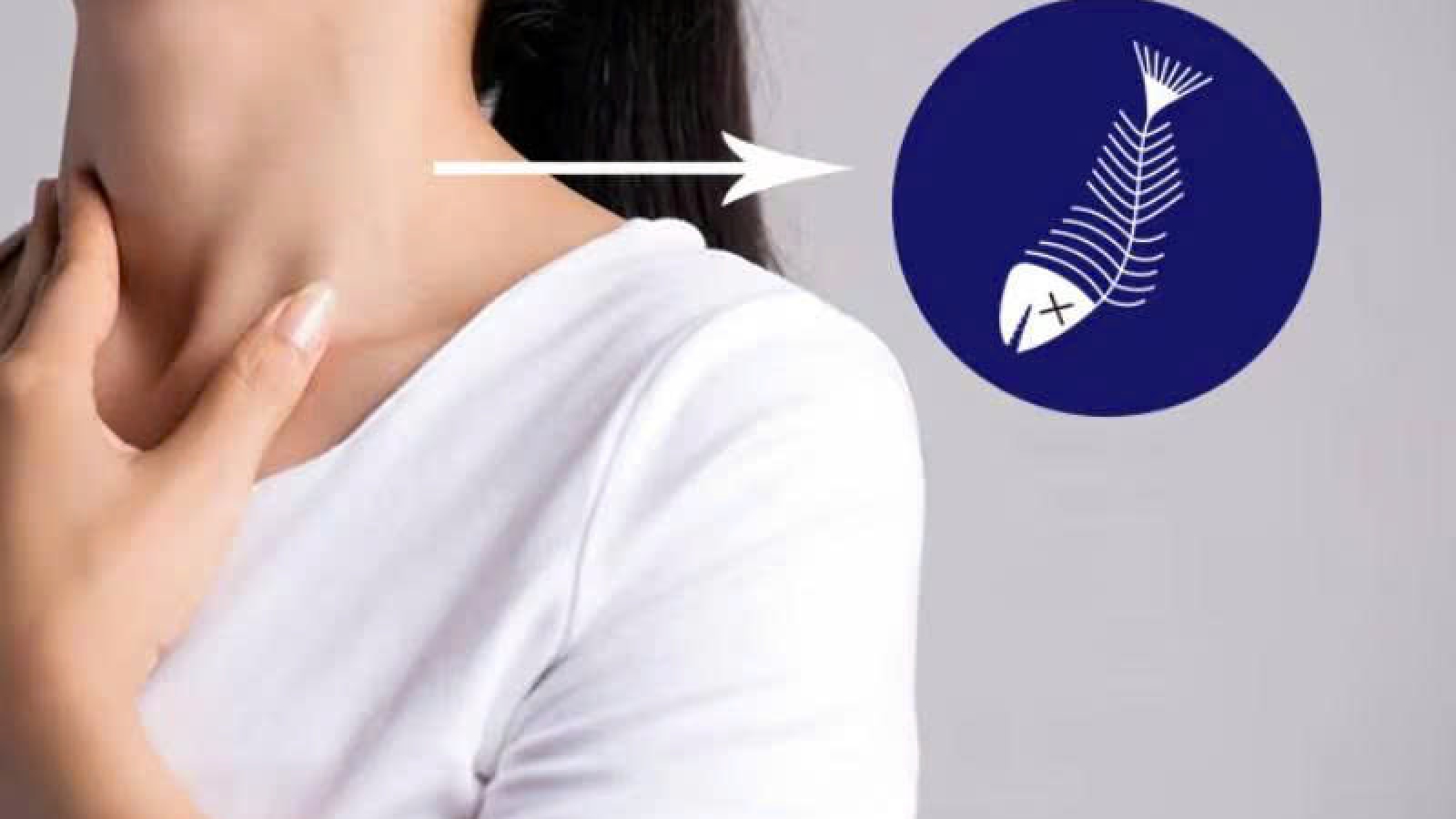 Hóc xương cá kéo dài nguy hiểm thế nào?