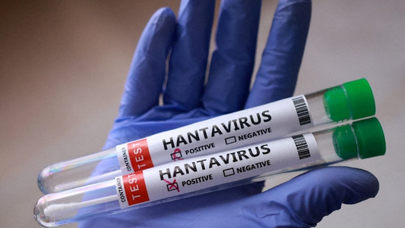 Truy vết Hantavirus: Các nhà khoa học bắt 70 con chuột ở "nơi tận cùng thế giới"