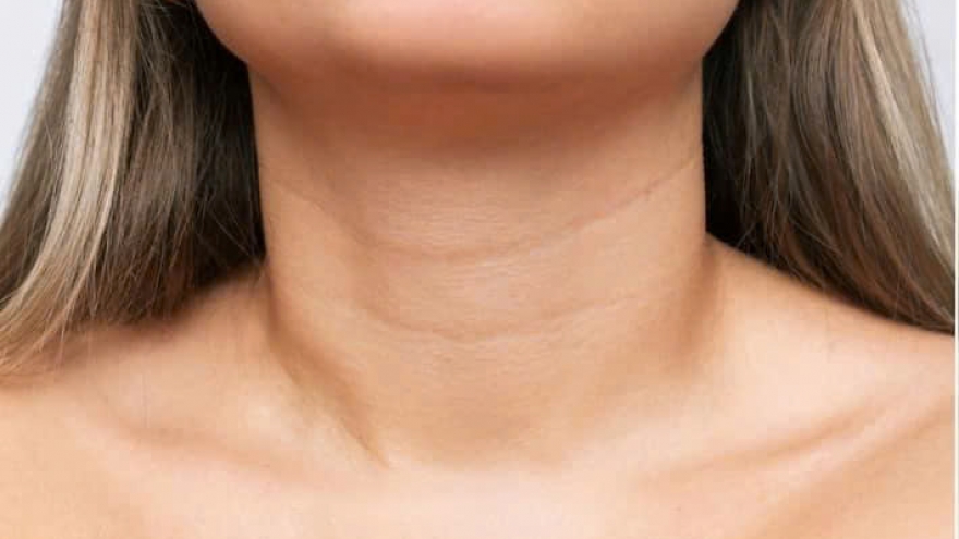 Nếp nhăn ở cổ ngày càng sâu: Làm sao cải thiện hiệu quả?