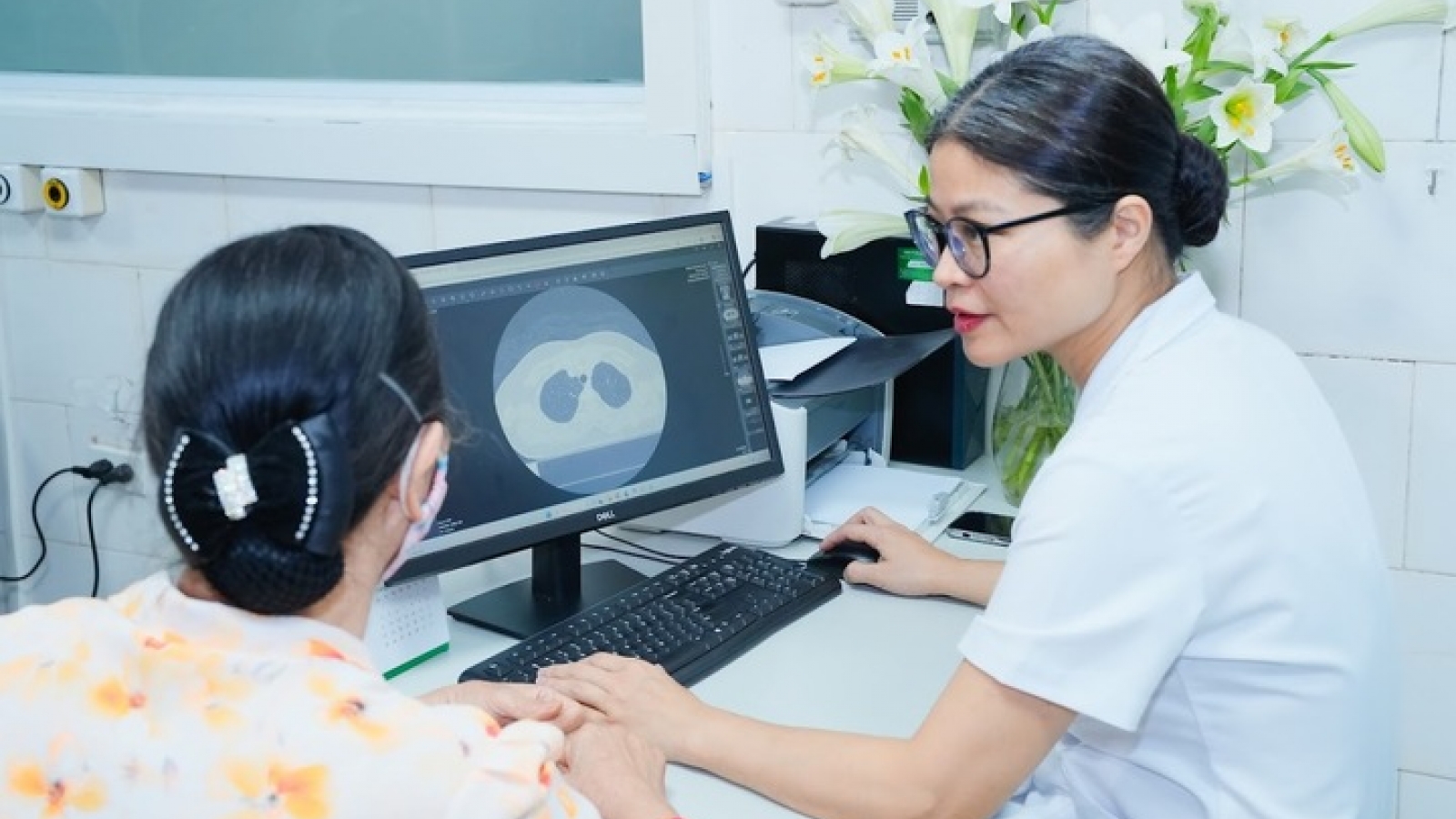 Đi khám miễn phí, hai người phát hiện nghi ung thư phổi dù không có triệu chứng
