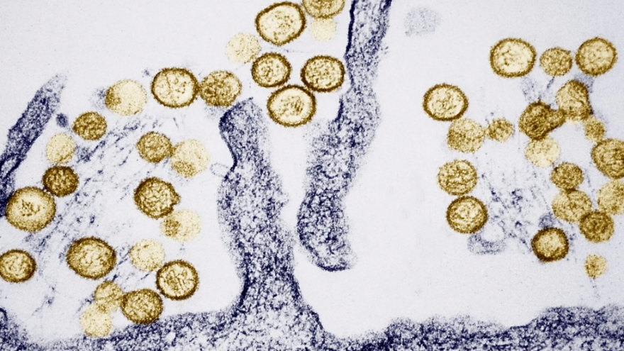 Virus Hanta bùng phát trên tàu du lịch xuyên Đại Tây Dương