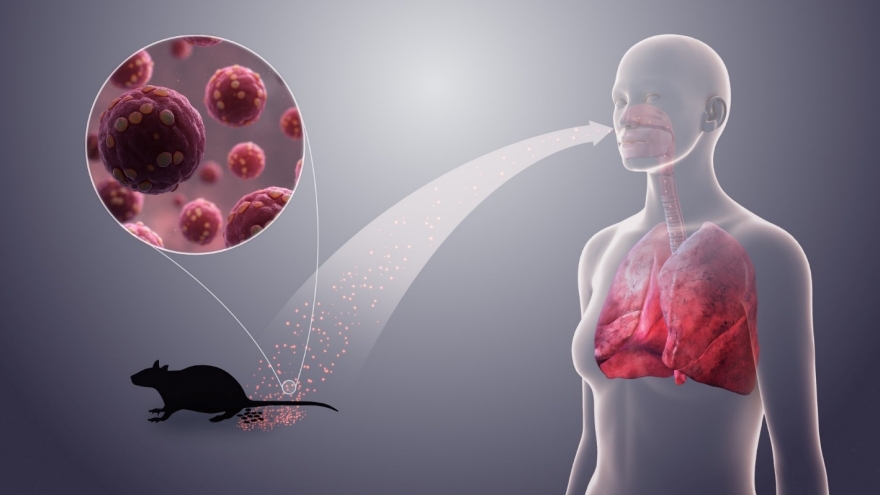 Triệu chứng nhiễm virus Hanta dễ nhầm với các bệnh khác, làm gì để phòng ngừa?