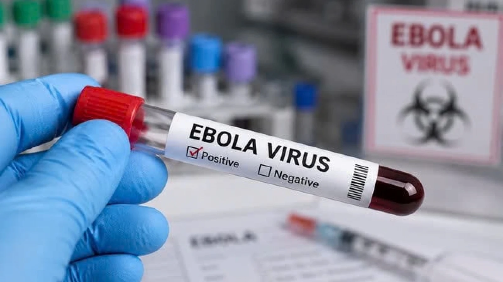 "2 phút vàng" khi khám bệnh có thể quyết định việc phát hiện ca nghi Ebola