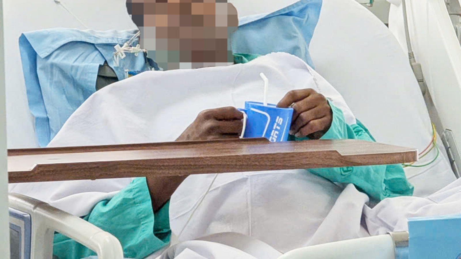 Nạn nhân nặng nhất vụ lật ca nô ở Phú Quốc qua giai đoạn nguy kịch