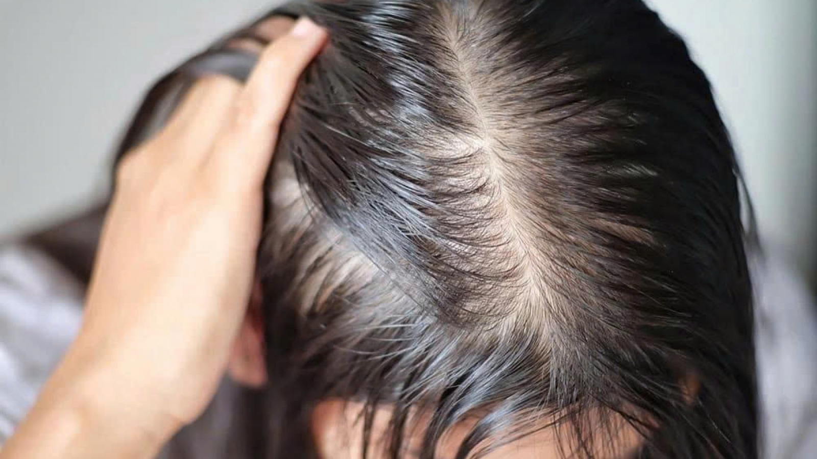 Tóc ngày càng thưa mỏng, rụng nhiều: Phụ nữ cần làm gì để giữ mái tóc khỏe đẹp?