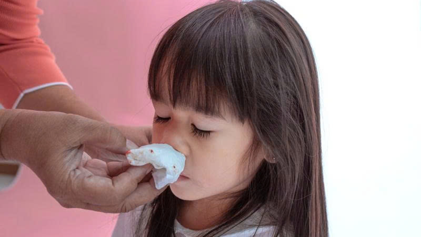 Trẻ hay chảy máu cam: Ăn gì để cải thiện nhanh và an toàn?