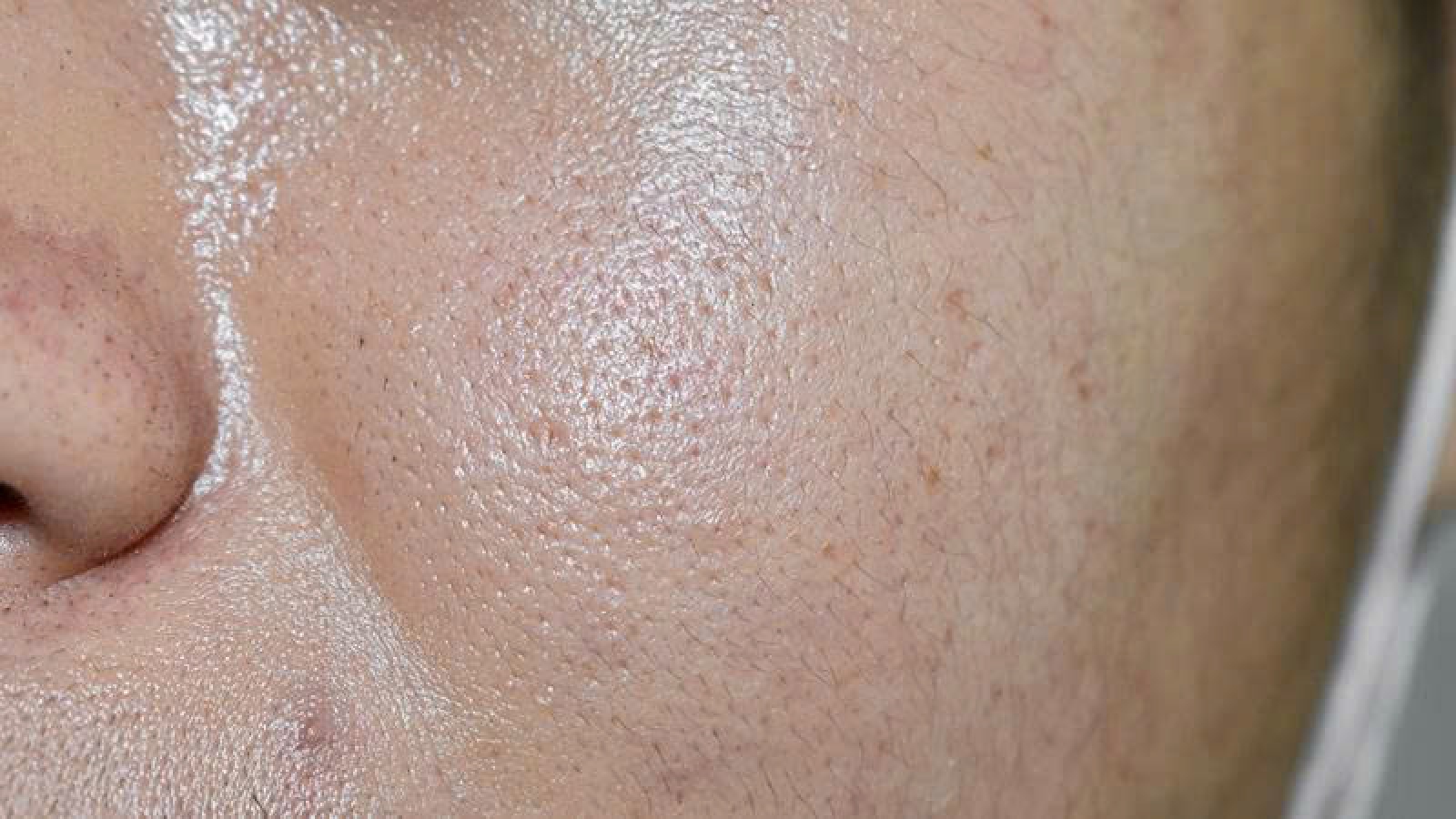 6 sai lầm khi chăm sóc da dầu khiến da càng đổ nhiều dầu