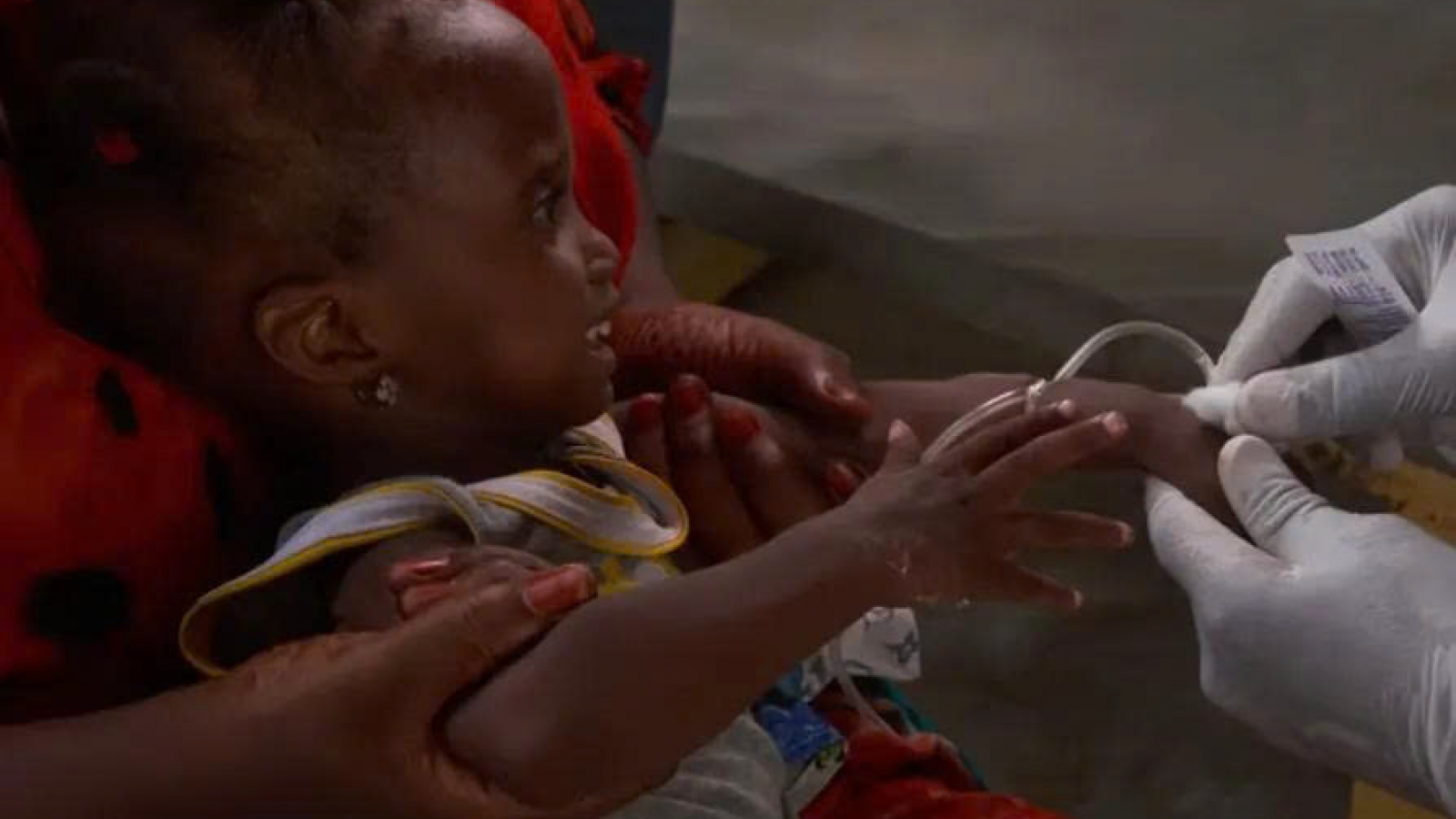120 người tử vong trong đợt bùng phát dịch tả mới nhất ở Sudan