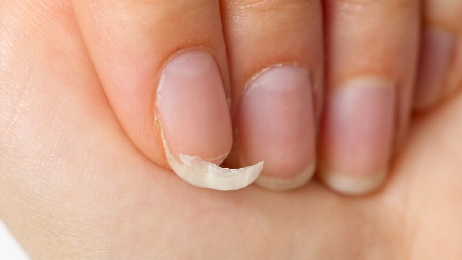 Móng tay giòn, dễ gãy là biểu hiện của những vấn đề sức khỏe không thể bỏ qua