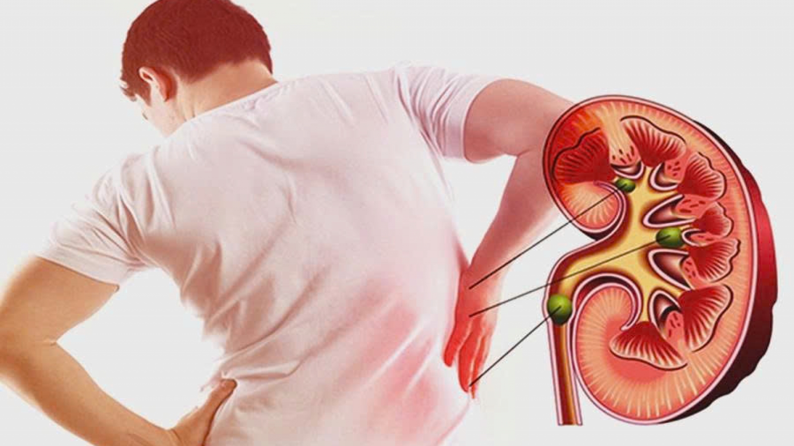 3 nhóm người có nguy cơ suy thận cao nhưng thường chủ quan