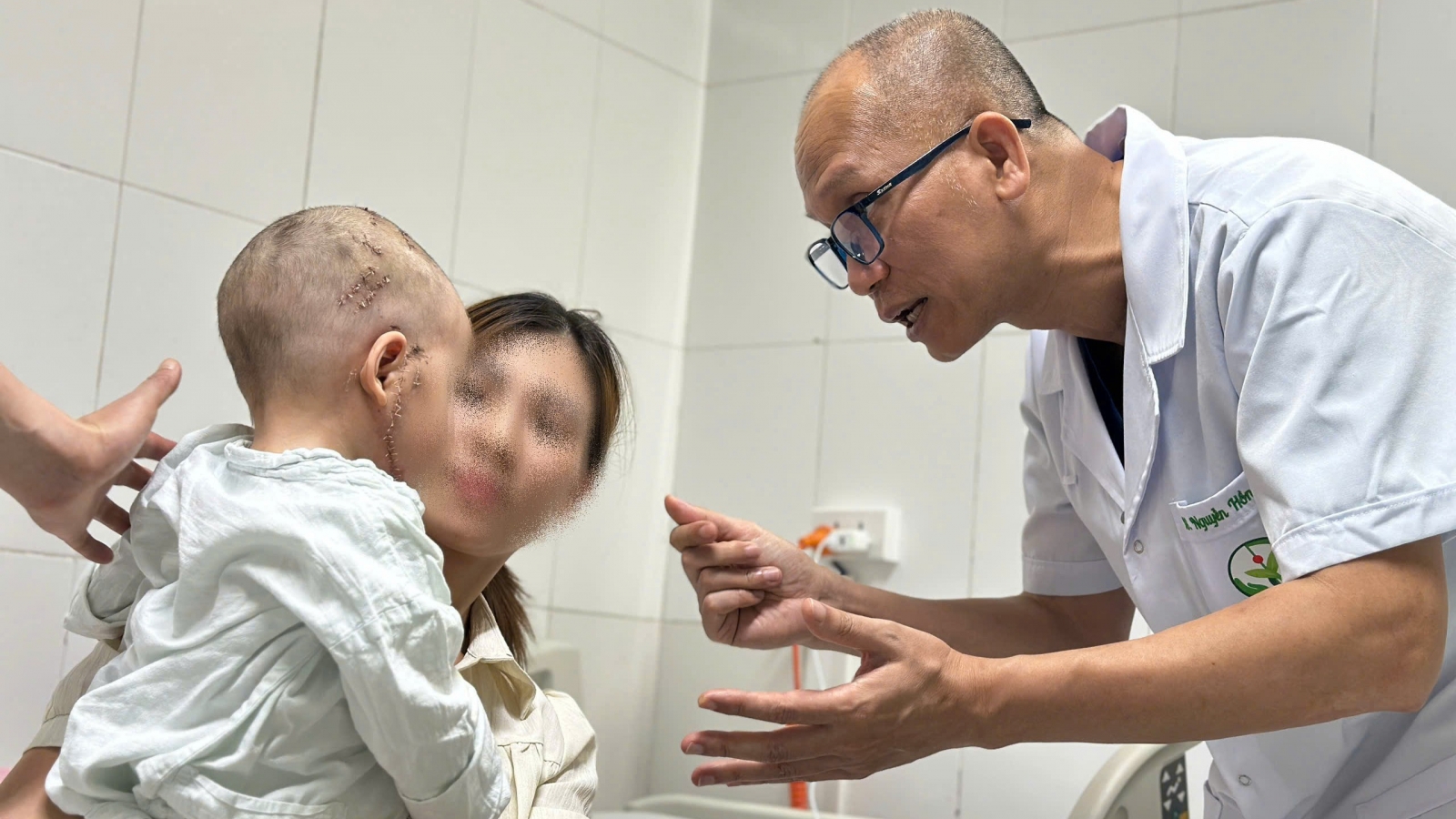 Trẻ 26 tháng bị chó cắn, 2 răng gãy lọt vào hốc mắt