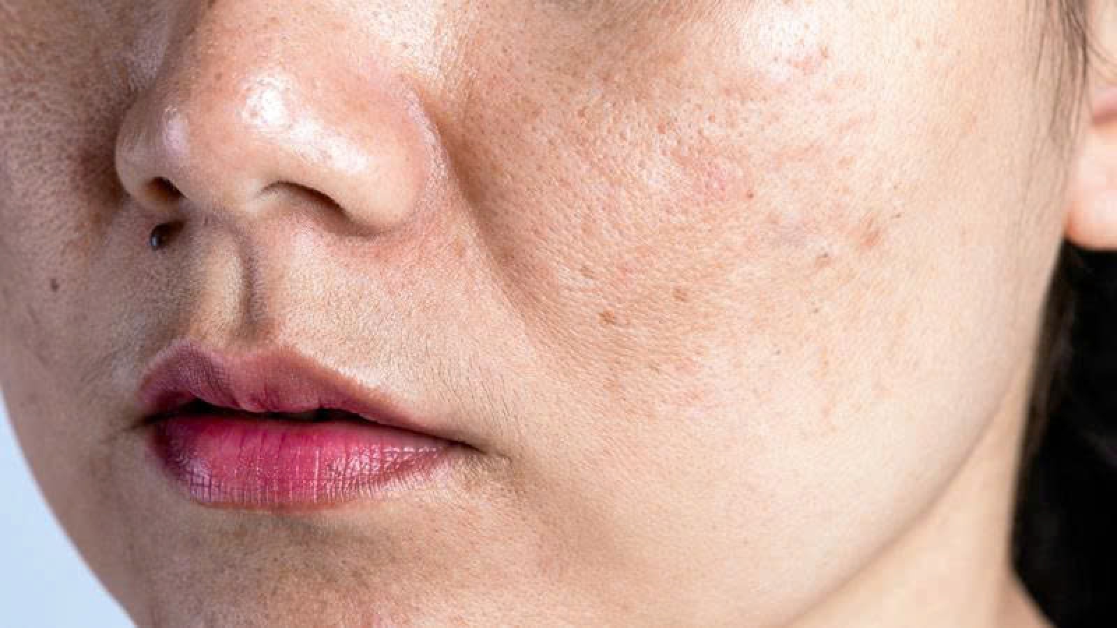 5 sai lầm mỗi ngày khiến da dễ nám hơn, nhiều chị em vẫn vô tình mắc