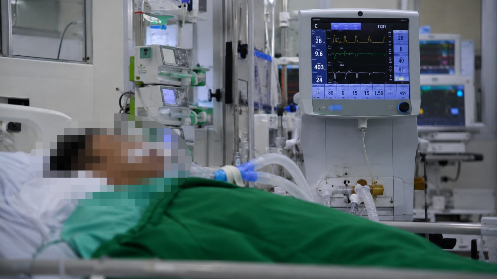 Thanh niên 28 tuổi phù não nguy kịch vì tự mua thuốc Nam trên mạng để uống