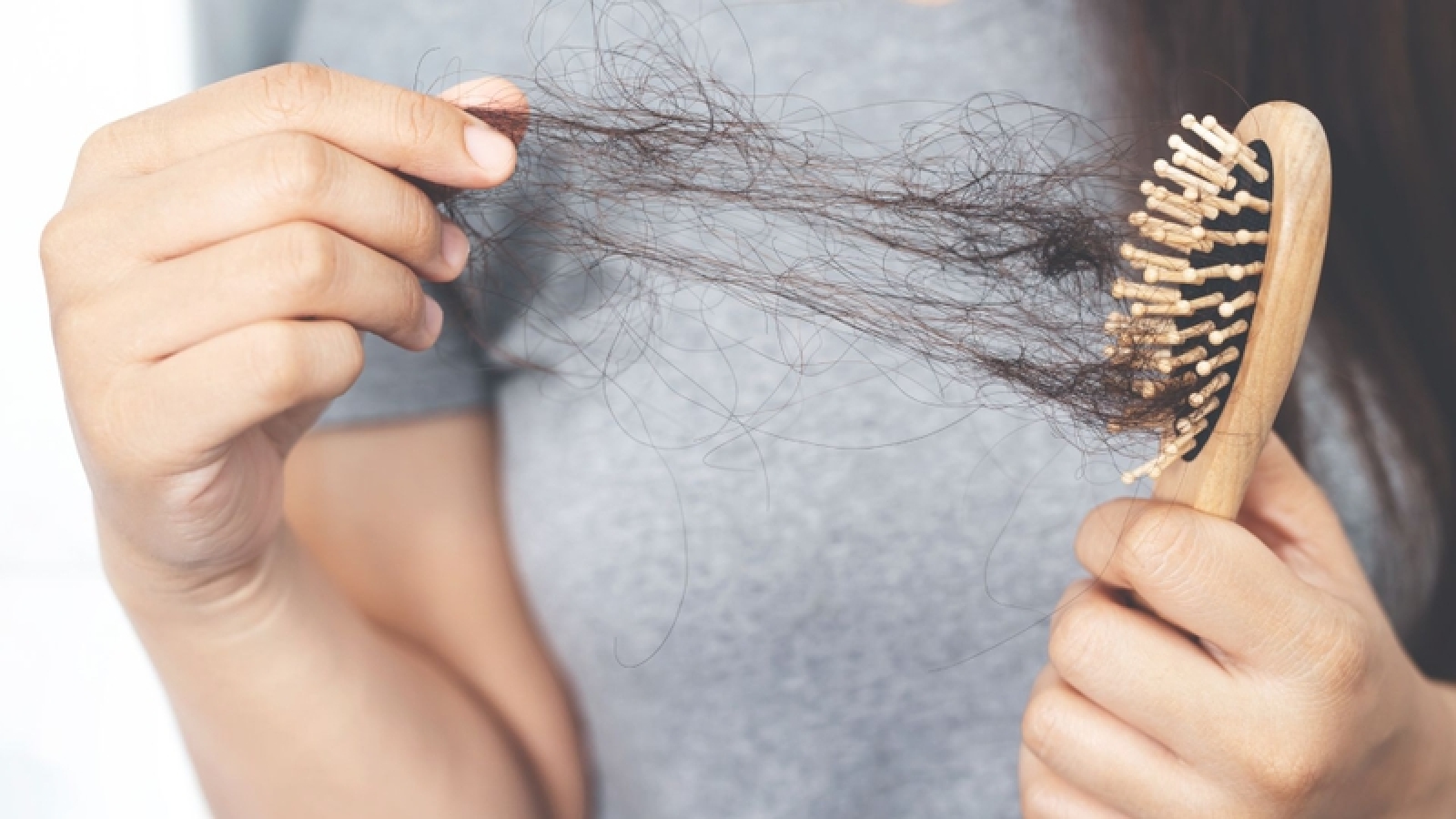 Tóc rụng nhiều mùa hè: 7 mẹo đơn giản giúp tóc chắc khỏe hơn