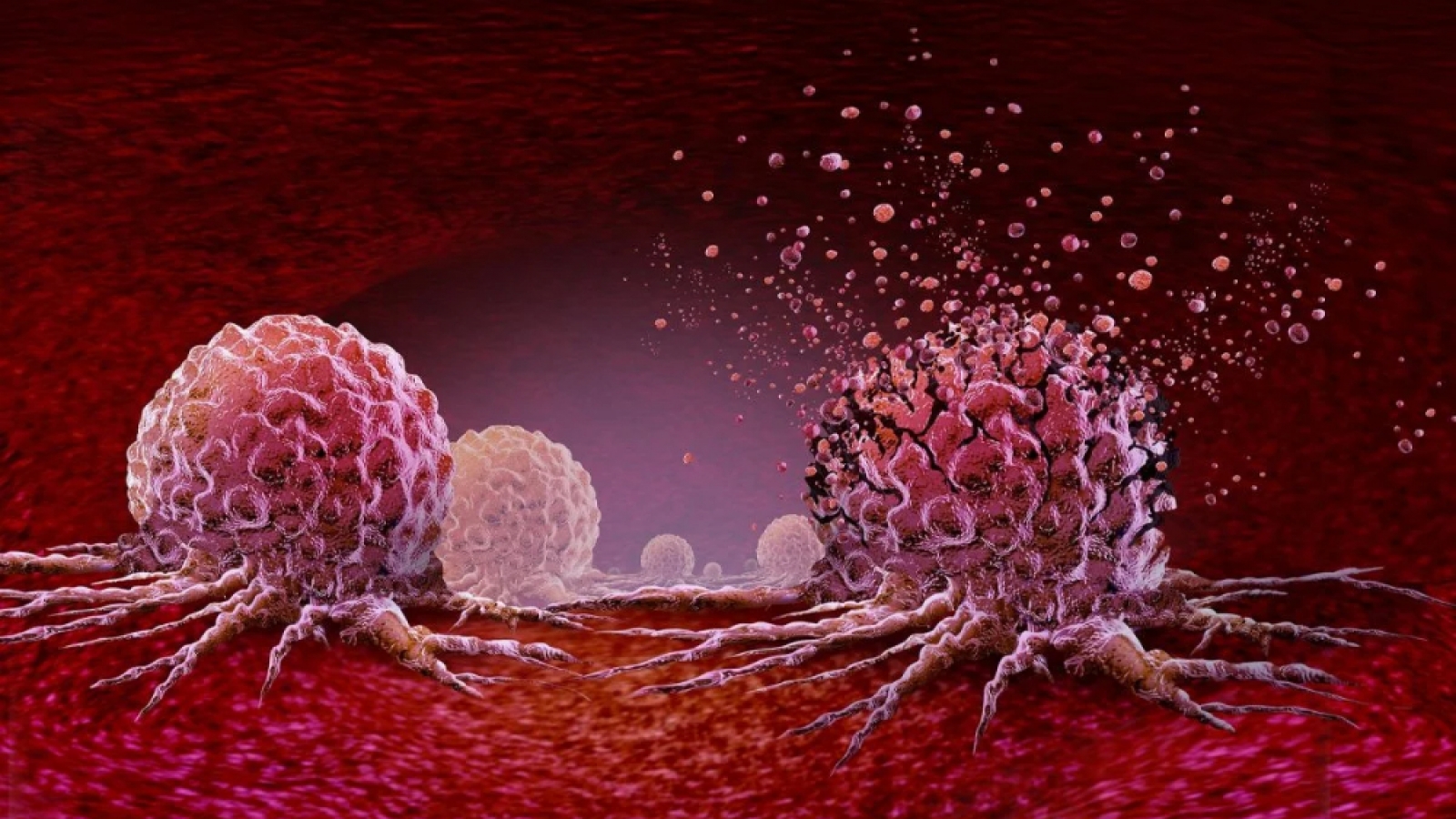Công nghệ mRNA mở hướng mới chống ung thư tuyến tụy