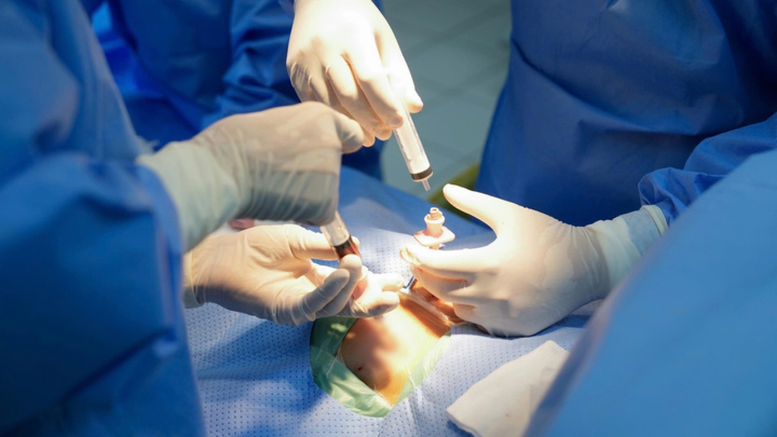 Thực hiện thành công ca ghép tuỷ từ người hiến nhỏ nhất Việt Nam