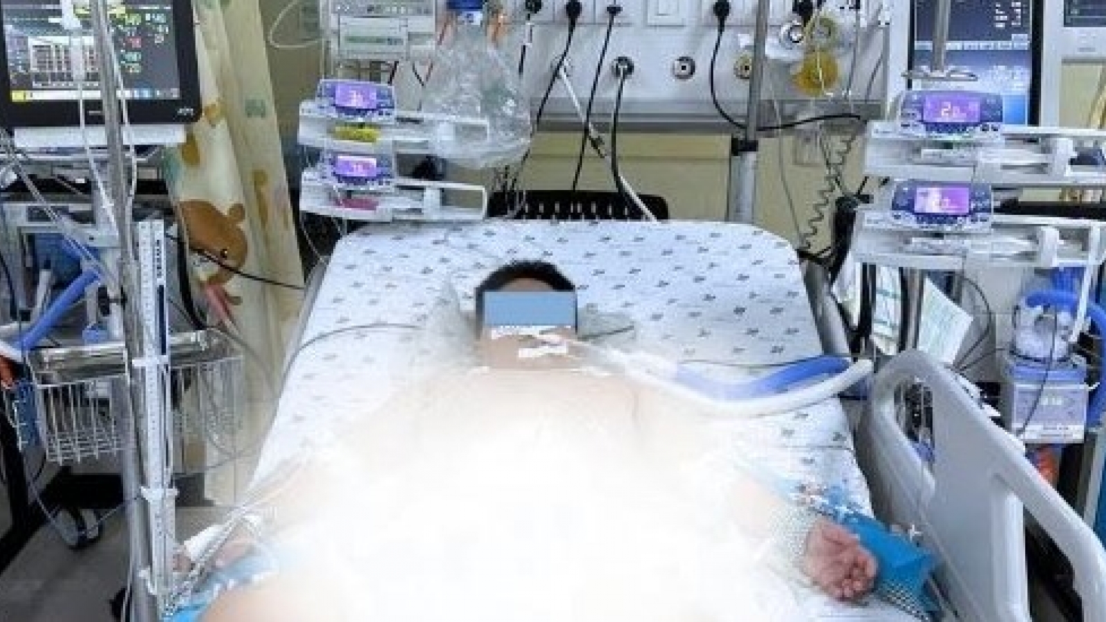 Sốc sốt xuất huyết diễn tiến nhanh, 2 trẻ suýt mất mạng
