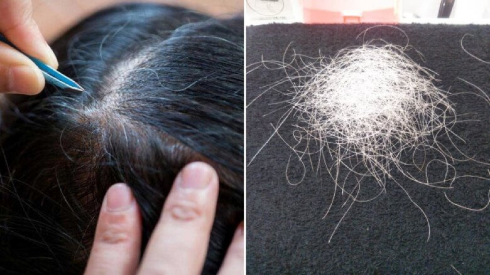 Thấy tóc bạc là nhổ: Thói quen tưởng vô hại nhưng có thể khiến tóc thưa dần