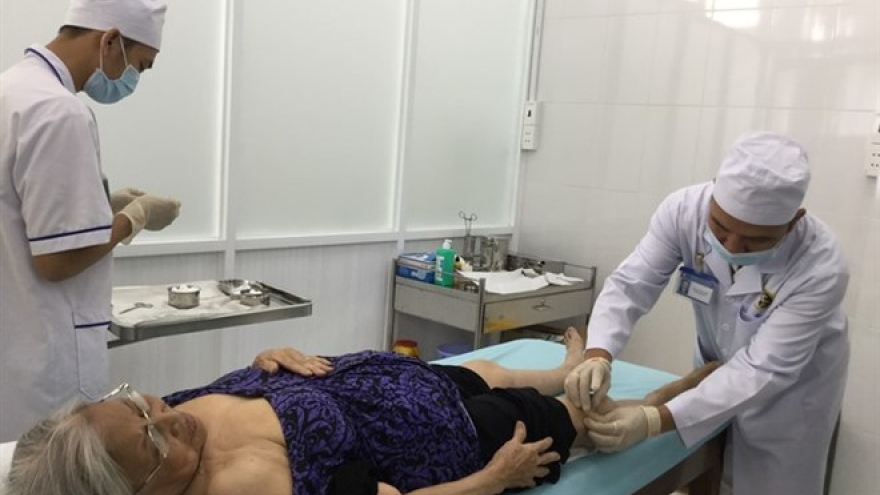 Acupuncture helps autistic children