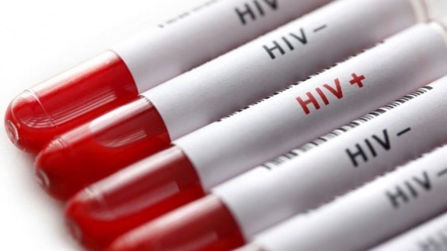 Vietnam keeps rate of new HIV cases lower 0.3%