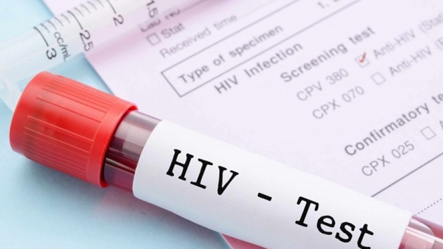 New strategy needed to improve HIV treatment quality
