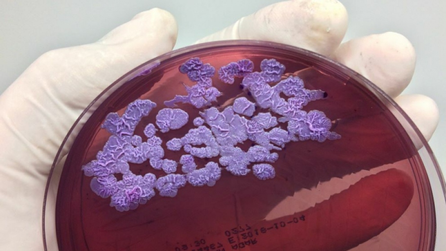 Infectious, lethal disease kills four in Hanoi