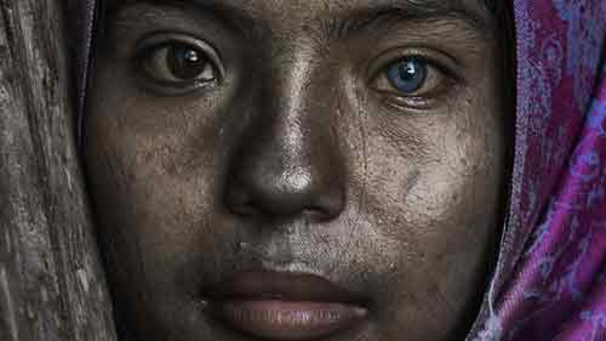 Meet a Cham ethnic girl with rare, striking eye colour