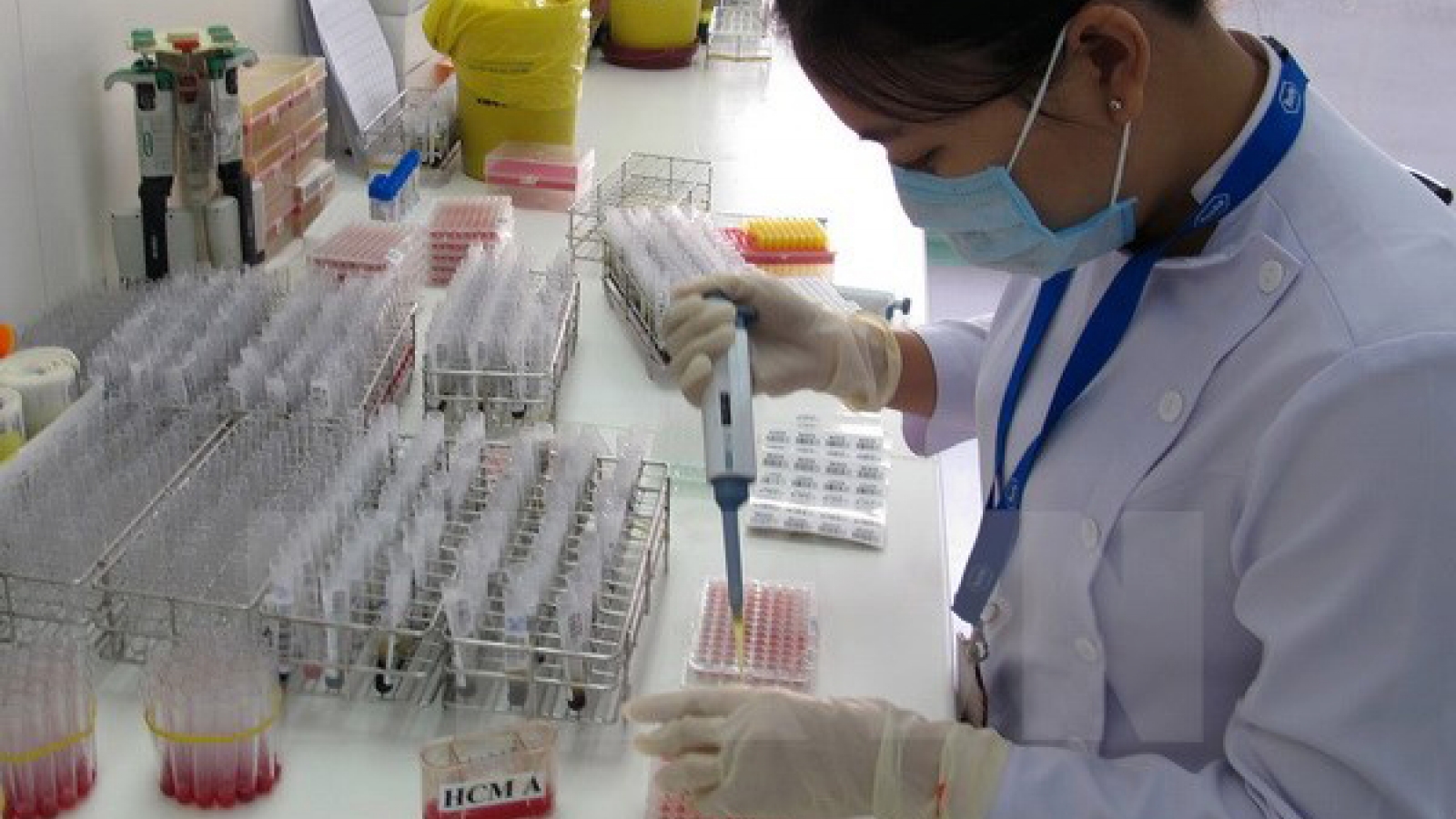 20th anniversary of first blood stem cell transplant