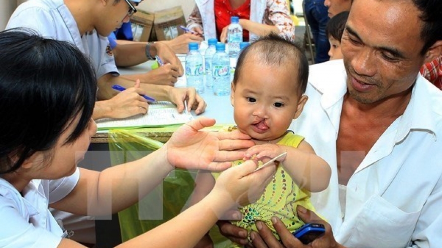 Free surgeries offered for cleft palate patients in Thua Thien-Hue